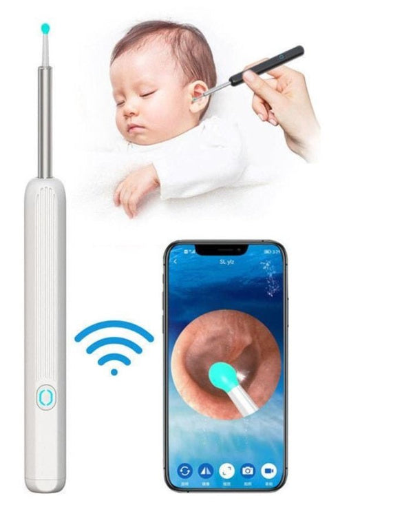 Smart Earwax Removal Kit with HD Camera & LED Light